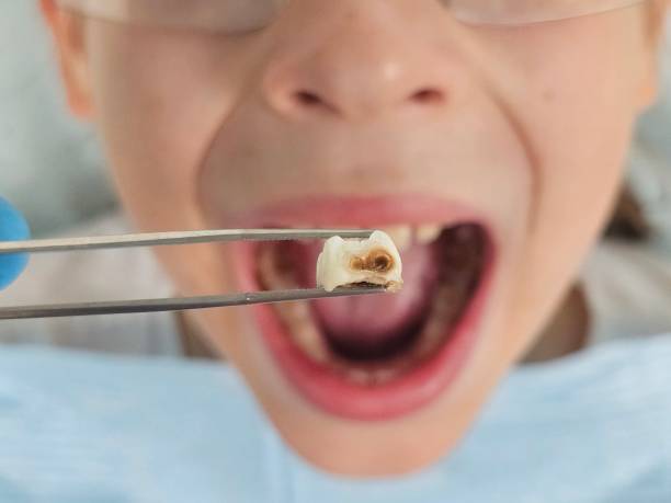 Best Emergency Gum Pain Relief  in Twinsburg Heights, OH