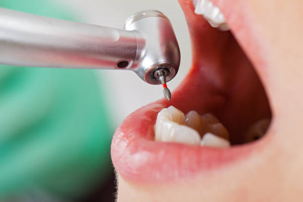 Best Urgent Tooth Repair  in Twinsburg Heights, OH
